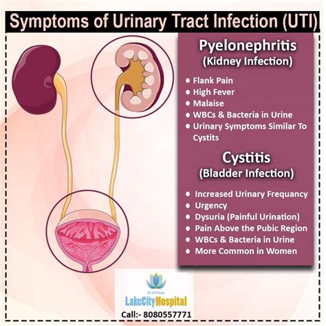 Pin on UROLOGIST