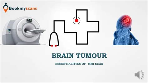 PPT - The Emotional Toll of Brain Tumor Treatment PowerPoint Presentation - ID:12455479