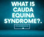 WHAT IS CAUDA EQUINA SYNDROME?.. – BACK PAIN BLOG UK…