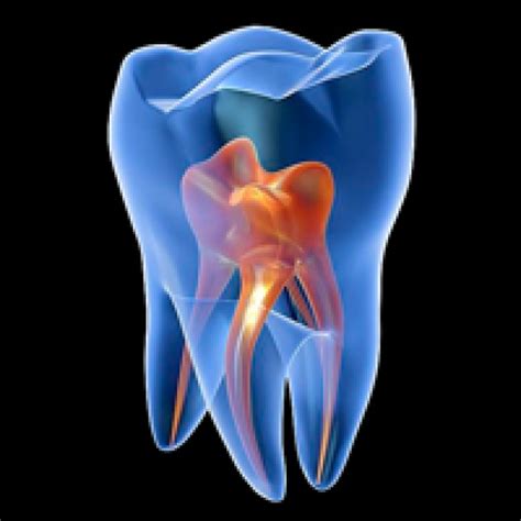 Endodoncia - Clínica Dental Augusta