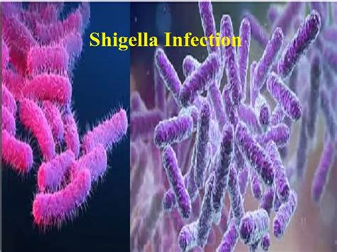 Shigella infection in Kerala: Symptoms, Causes, Prevention, and Treatment