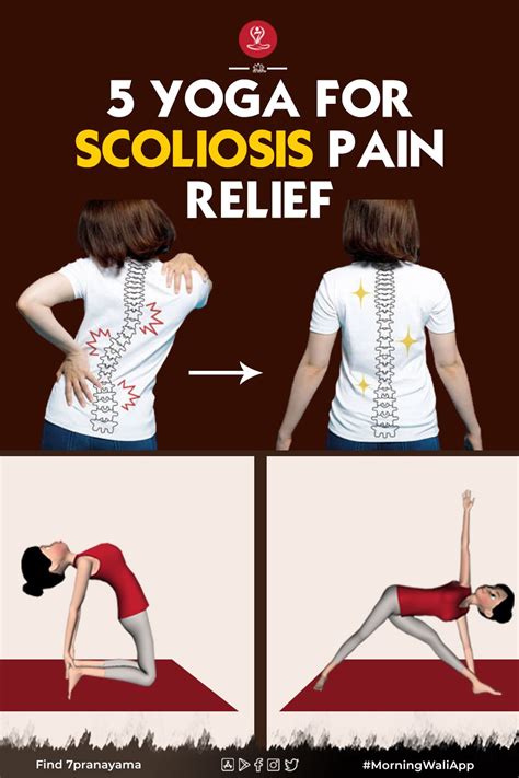 5 Top Scoliosis Exercises Scoliosis Exercises Scoliosis Yoga For ...