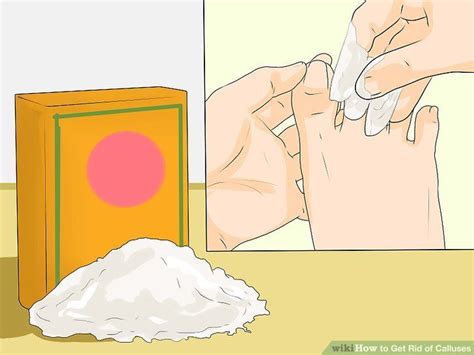 3 Ways to Get Rid of Calluses - wikiHow Best Callus Remover, Callus ...