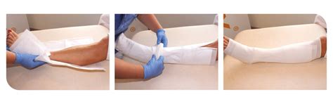 Large wound dressing for exuding leg ulcers | Absorbest