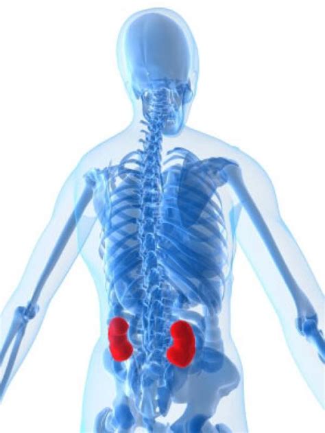 Pain Management Aid: Back Pain That Refers To Kidney Stone