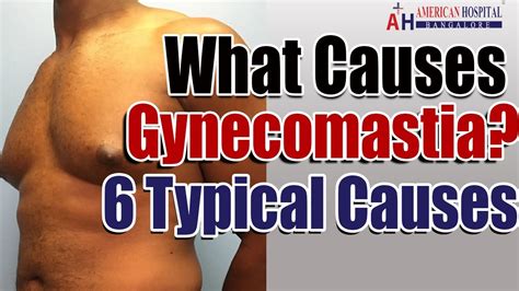 What Causes Gynecomastia? 6 Gynecomastia Causes! - YouTube