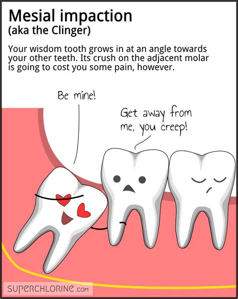 Wisdom teeth personalities | superchlorine