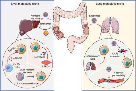 Frontiers | Tumor Microenvironment Shapes Colorectal Cancer Progression ...