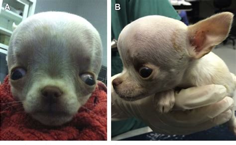 Figure 1 from Congenital Hydrocephalus. | Semantic Scholar