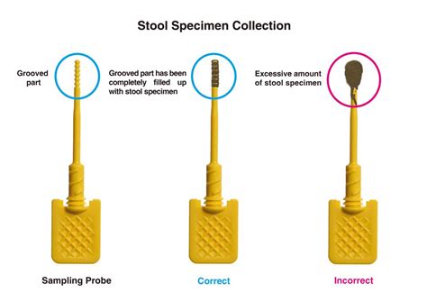 How to collect stool specimen | Prevent Colorectal Cancer