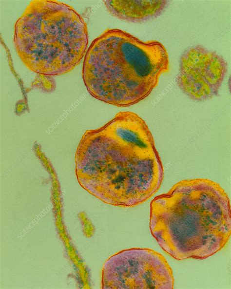 Chlamydia psittaci bacteria - Stock Image B220/0733 - Science Photo Library