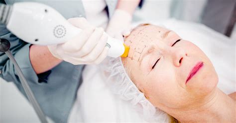 Thermage vs. Ultherapy: Candidates, Procedures & More