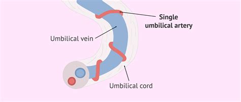 Anatomy Umbilical Cord Two Umbilical Veins One Umbilical, 53% OFF