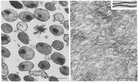 Peroxisome Micrograph