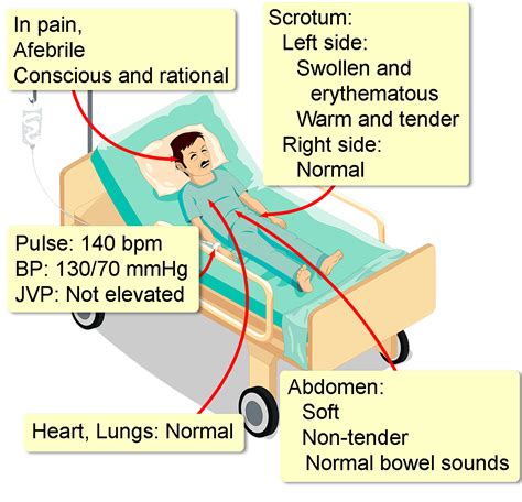 Testicular Torsion Diagnosis