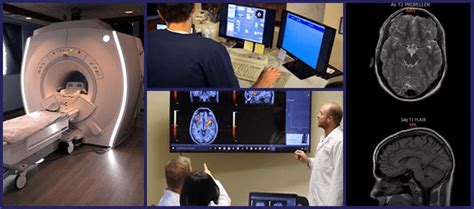 Duke Study on fMRI Brain Scans for Post-Concussion Syndrome Detection