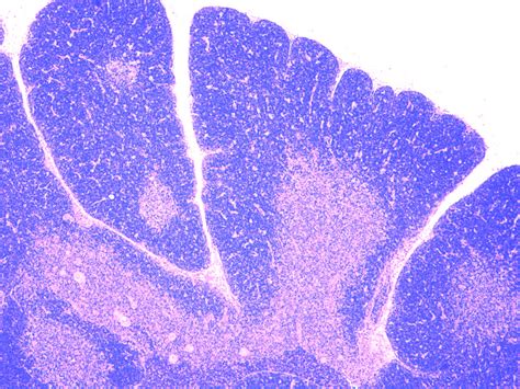 Thymus Lobule