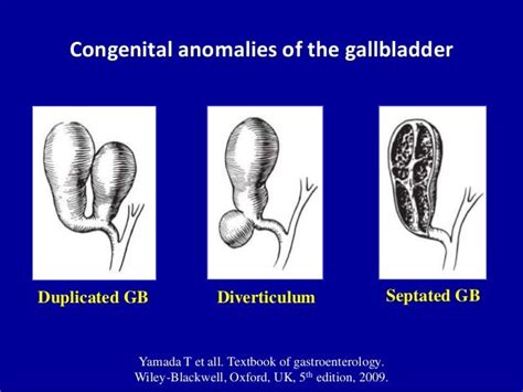 Ultrasound of the gallbladder