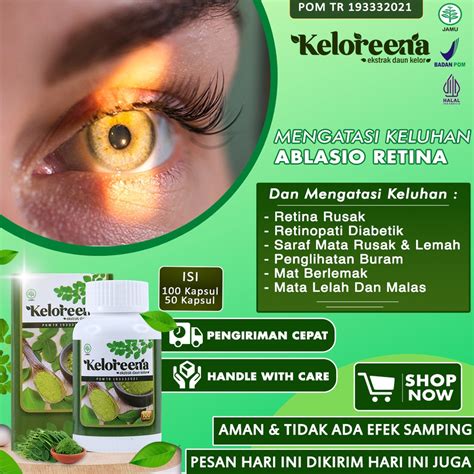 Jual Obat Ablasio Retina Saraf Mata Rusak Dan Lemah Retina Rusak Mata ...