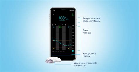 Guardian Connect Continuous Glucose Monitoring - Medtronic CGM