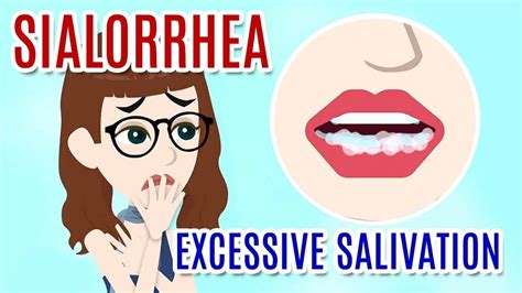 SIALORRHEA (EXCESSIVE SALIVATION): Causes, Diagnosis and Treatments - YouTube