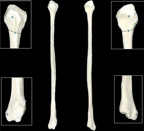 Fibula Diagram | Quizlet