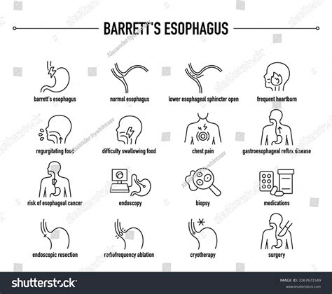 Barretts Esophagus Symptoms Diagnostic Treatment Vector Stock Vector ...