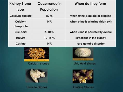 Urinary Stone analysis