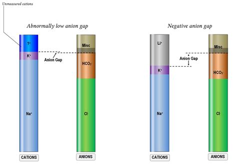 The anion gap; its merits and demerits | Deranged Physiology