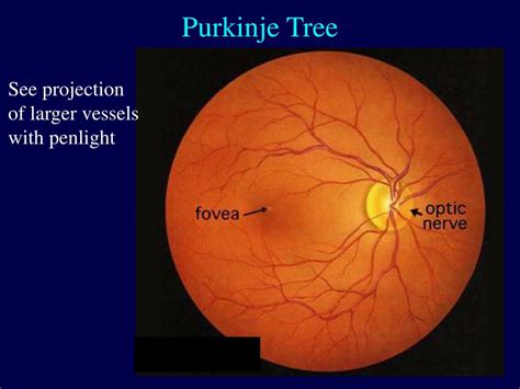 PPT - Entoptic Phenomena of Retinal Origin PowerPoint Presentation, free download - ID:3000967