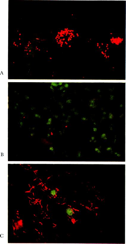 Acridine orange staining of clinical specimens using an acidic staining... | Download Scientific ...