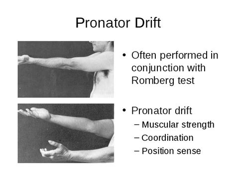 Pronator Drift Legs