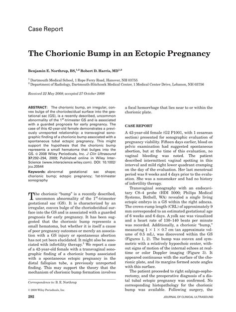 SOLUTION: The chorionic bump in an ectopic pregnancy abnormal gestational sac shape chorionic ...