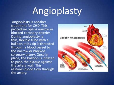 Types Of Open Heart Surgery