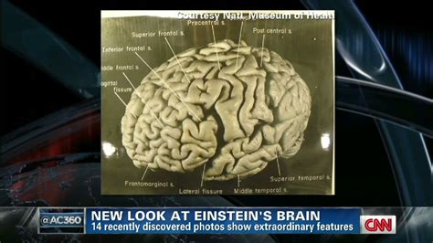 Einstein Brain Vs Normal Brain