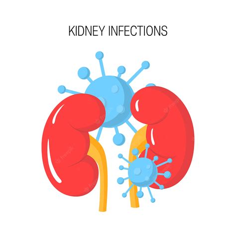 Premium Vector | Kidney infection concept isolated on white