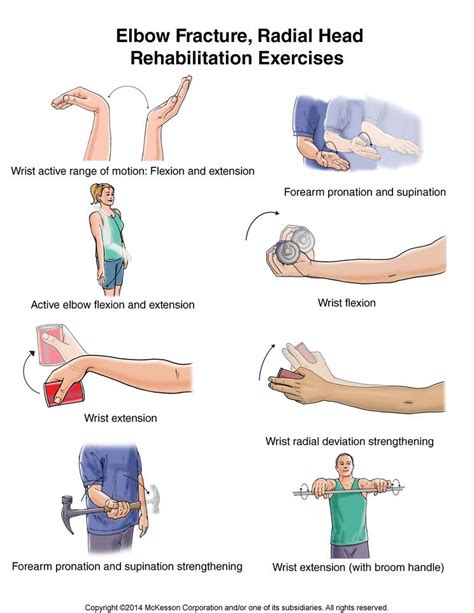 Physical therapy exercises, Nerve palsy, Radial nerve