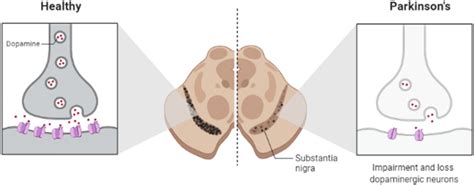 A schematic diagram of substantia nigra pars compacta region of healthy... | Download Scientific ...