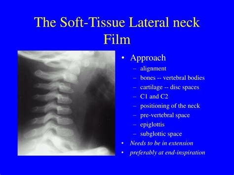 PPT - Peds Soft Tissue Neck Xrays PowerPoint Presentation, free download - ID:518700