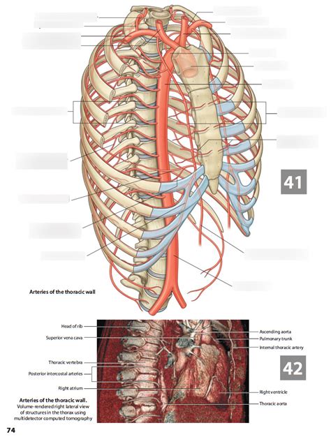 Thoracic Arteries Diagram