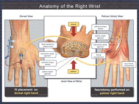 Anatomy of the Right Wrist - TrialQuest Inc.