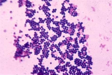 Gram Stain Staphylococcus Aureus submited images.