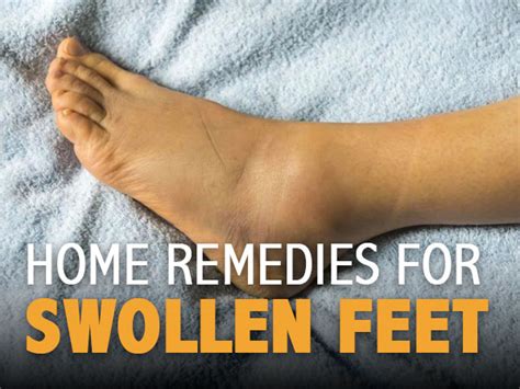 12 Effective Home Remedies For Swollen Feet - Boldsky.com