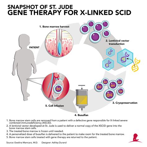 St. Jude gene therapy improves immunity in babies with ‘bubble boy’ disease