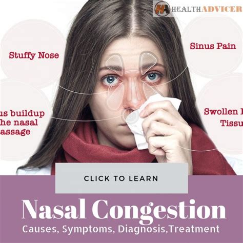 Nasal Congestion