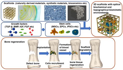 IJMS | Free Full-Text | Current Biomaterial-Based Bone Tissue Engineering and Translational Medicine