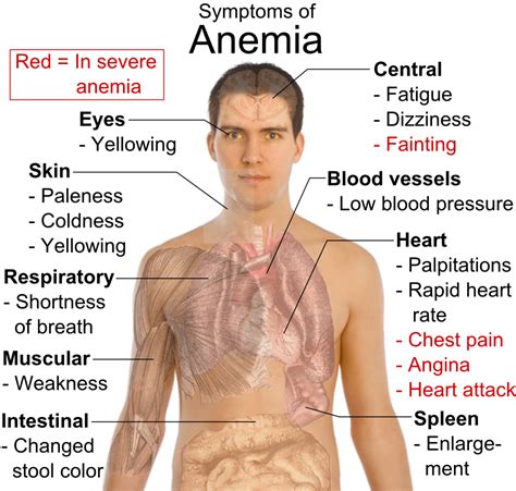 iron deficiency anemia symptoms | chemical elements