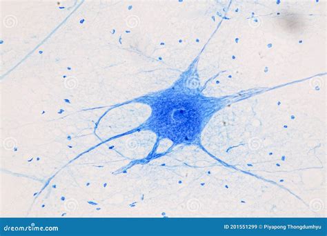 Motor Neuron Under the Microscope. Stock Image - Image of light, dendrite: 201551299