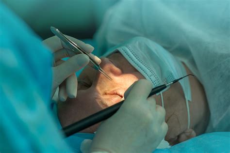 Cornea Transplant Surgery in India