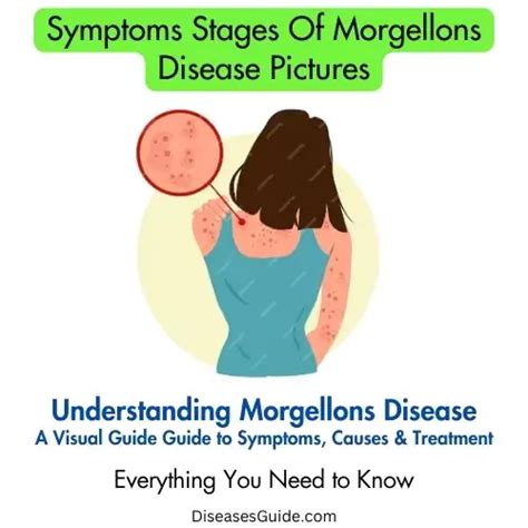 Symptoms Stages Of Morgellons Disease Pictures